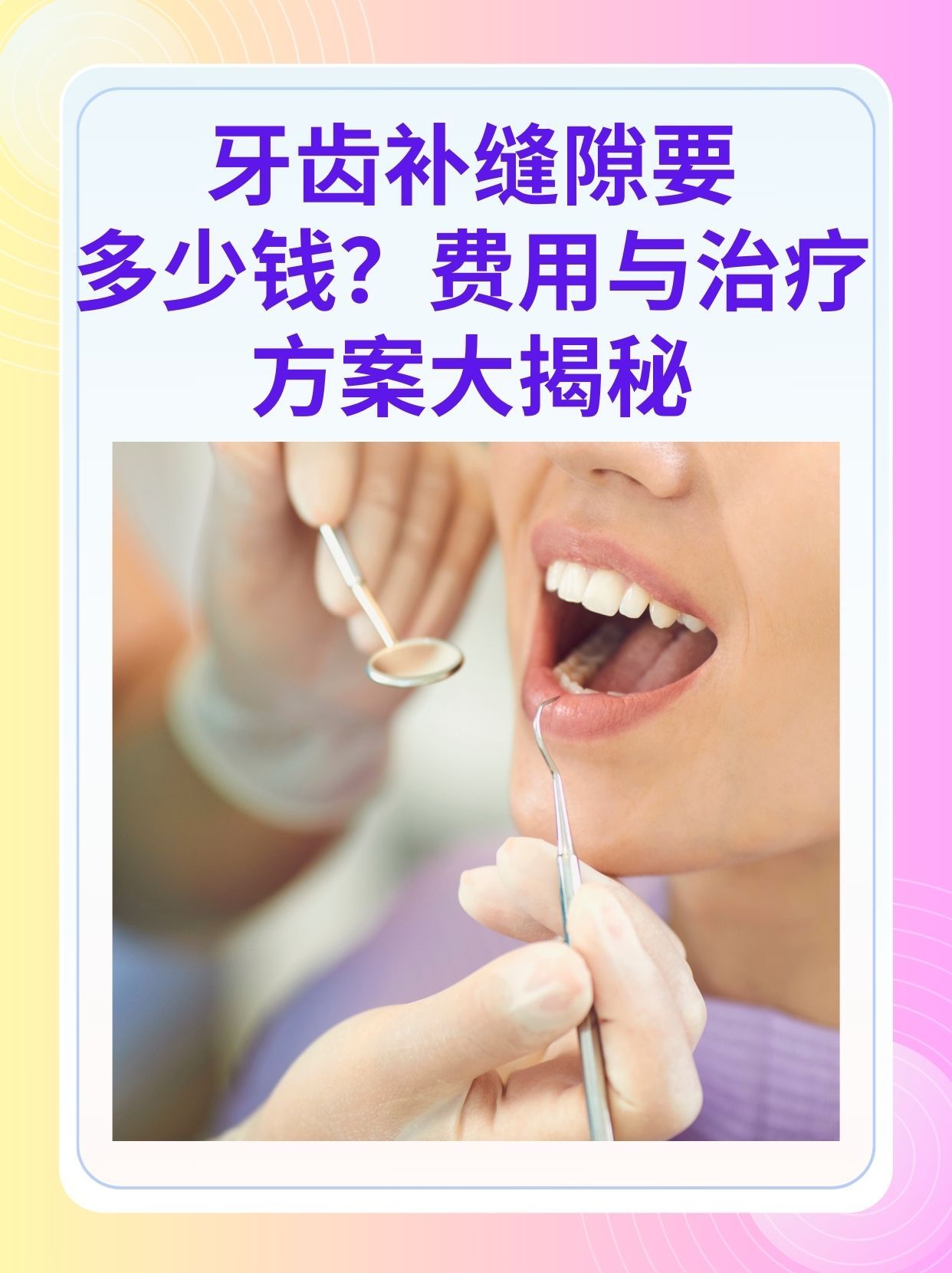 四平补牙医保可以报销吗(补牙医保可以报销吗 哪些可以报销呢)